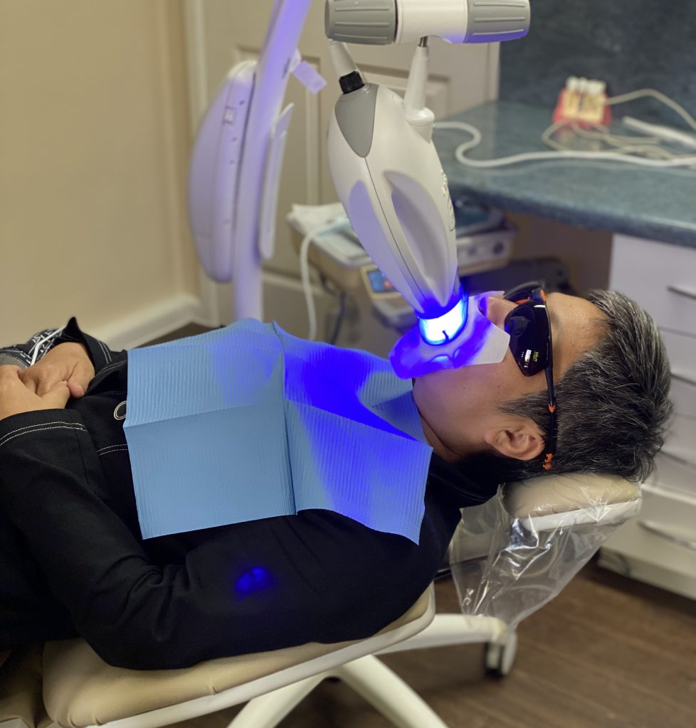 Is Teeth Whitening Safe? South Gables Dental